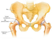 Legg-Calve-Perthes Disease